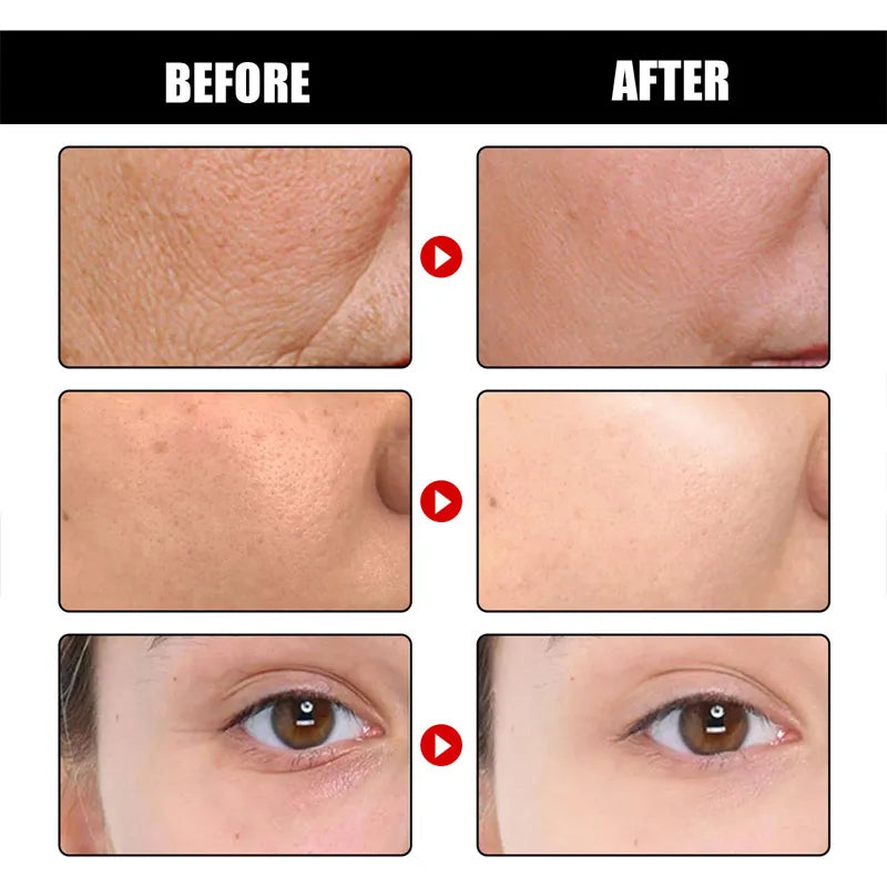 Collagen Wrinkle Remover Face Serum Anti Aging Whitening Moisturizing Fade Fine Lines Dark Spots Brightening Korean Cosmetics