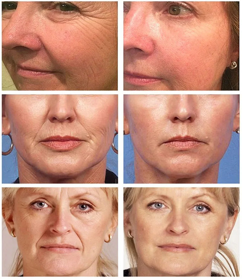 Collagen Wrinkle Remover Face Serum Anti Aging Whitening Moisturizing Fade Fine Lines Dark Spots Brightening Korean Cosmetics